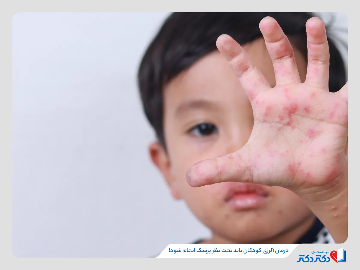 درمان آلرژی کودکان، گاهی وابسته به افزایش سن آن‌ها و تکامل سیستم ایمنی است. 