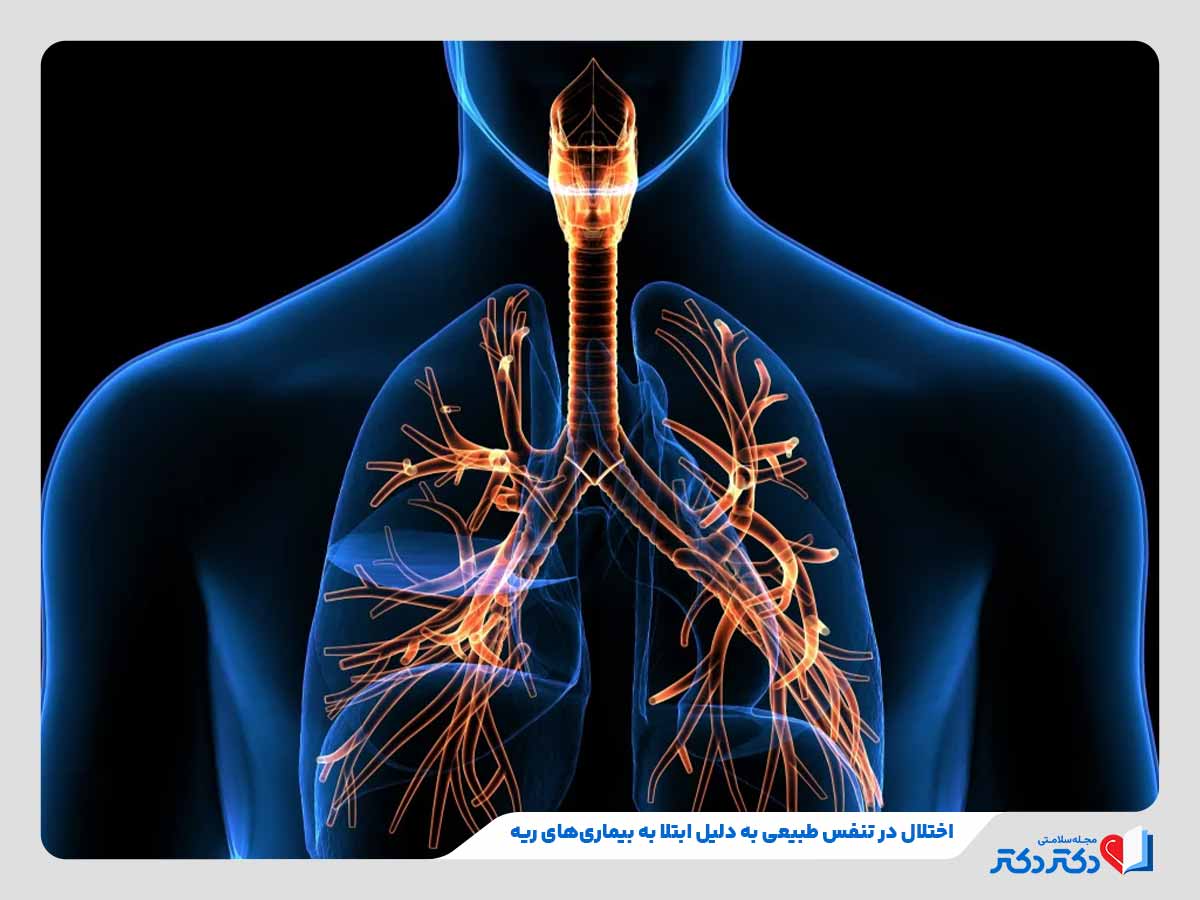 اختلال در تنفس طبیعی به دلیل ابتلا به بیماری های ریه