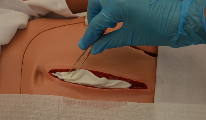 راهنمای عمل آپاندیس: از عوارض سپس از عمل آپاندیس تا حالت تهوع سپس از عمل آپاندیس_رنگو 13 مراقبتهای بعد از عمل آپاندیس - پانسمان زخم باز