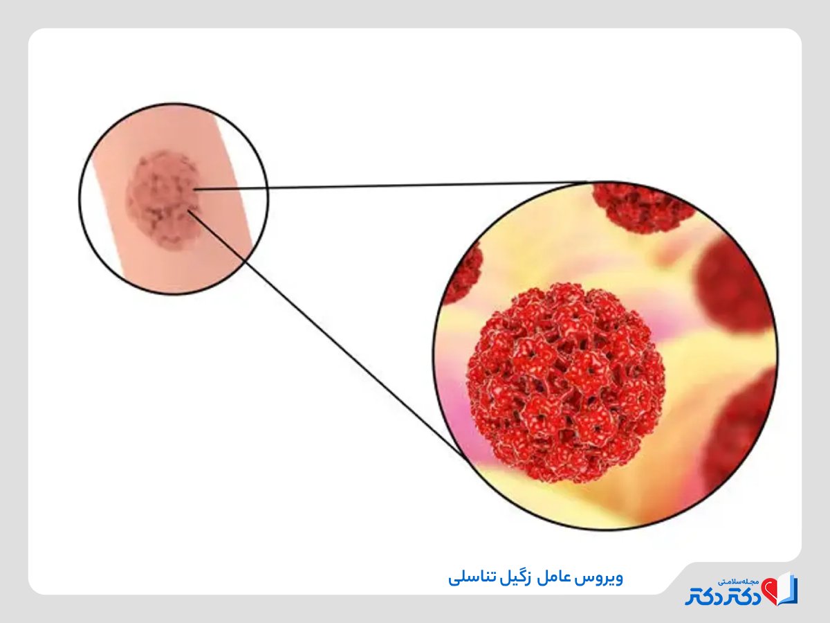 1751483313 607 زگیل تناسلی چیست و چطور منتقل می‌بشود؟ علائم و راه‌های