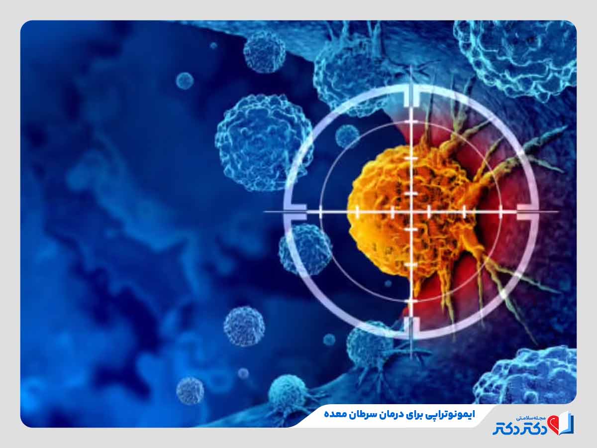 درمان سرطان معده با ایمونوتراپی