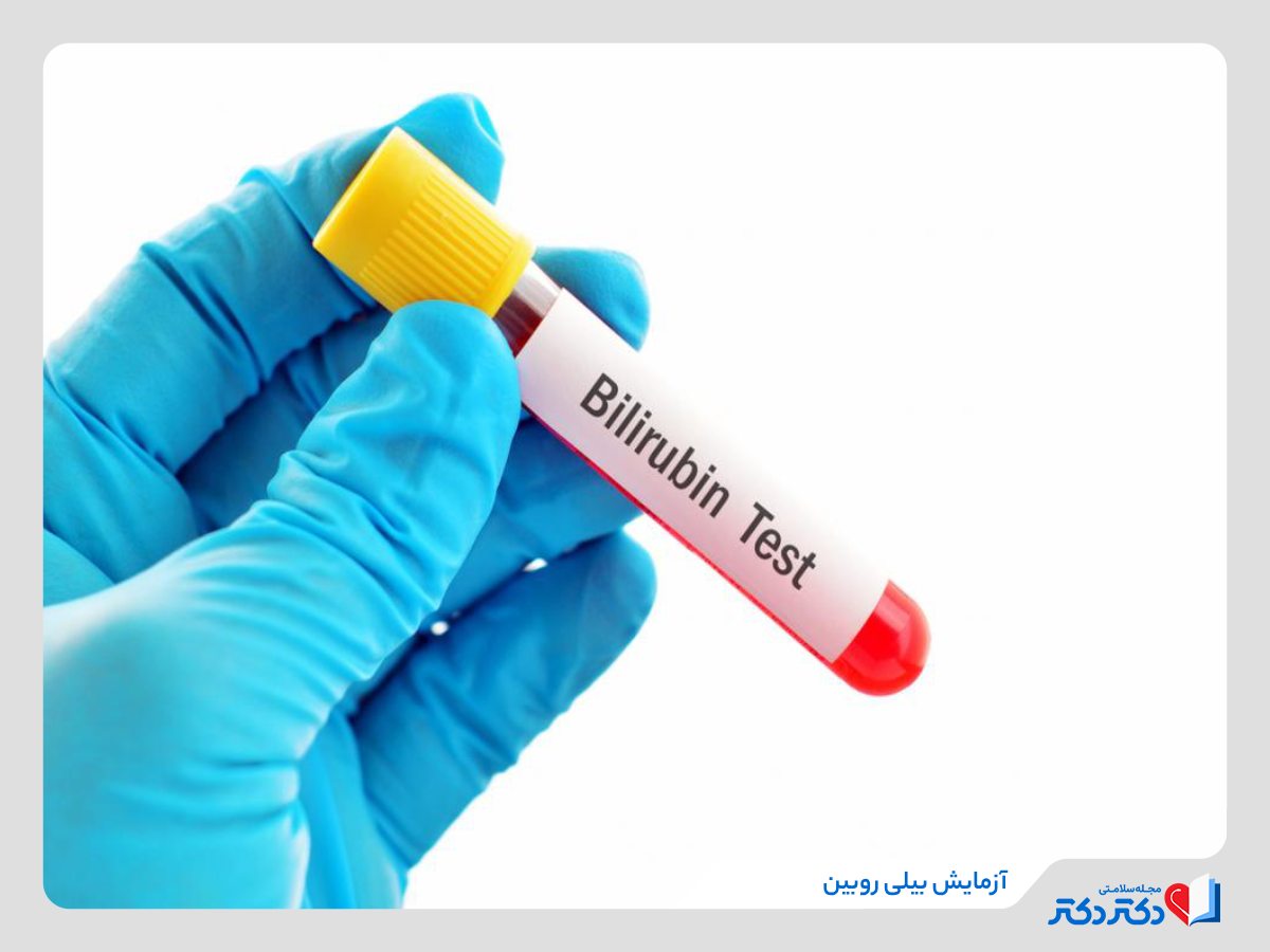 چطور بیلی روبین را افت دهیم و از بالارفتن آن جلوگیری کنیم؟_رنگو 16 آزمایش تشخیص سطح بیلی روبین