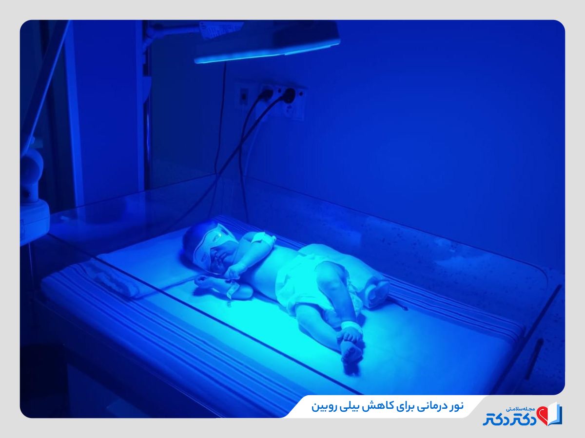 نودرمانی برای کاهش بیلیروبین