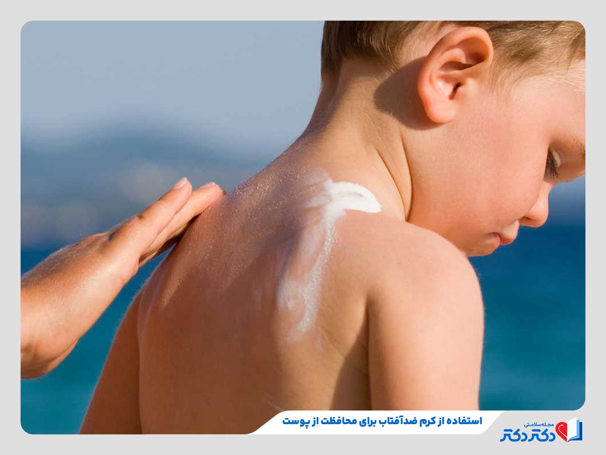 کودک در حال استفاده از کرم پدافتاب برای محافظت از تابش خورشید با شاخص یو وی متوسط به بالا