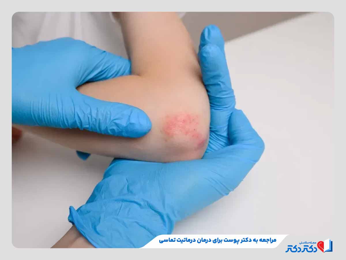 درماتیت تماسی چیست؟ + علائم، علل و راه حلهای درمان آن_رنگو 8 دکتر پوست در حال معاینه فرد برای تشخیص درماتیت تماسی