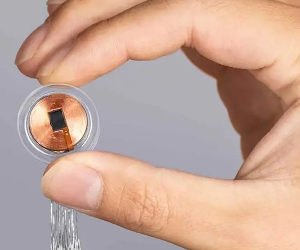 ایمپنت مغزی نورالینک