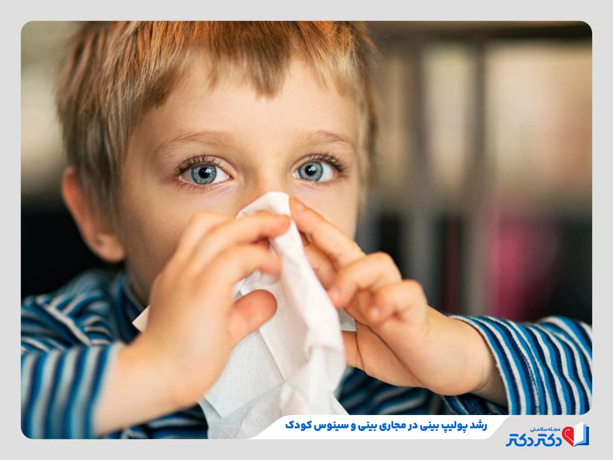 کودک مبتلا به پولیپ و بررسی پولیپ بینی در کودکان و گرفتگی بینی